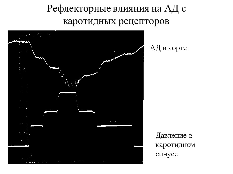 Рефлекторные влияния на АД с каротидных рецепторов АД в аорте  Давление в каротидном